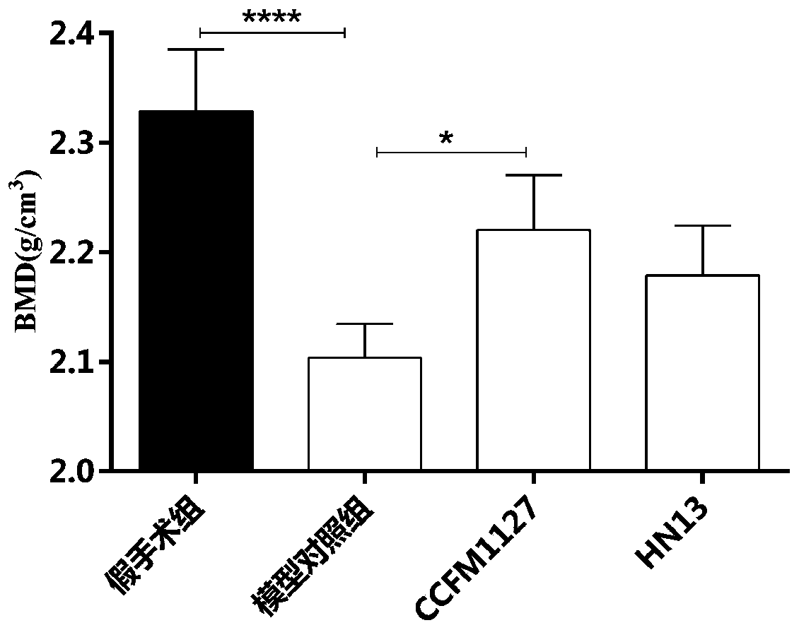 Lactobacillus casei capable of relieving osteoporosis and application of lactobacillus casei