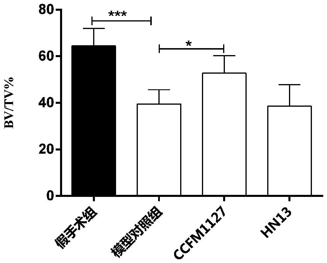 Lactobacillus casei capable of relieving osteoporosis and application of lactobacillus casei