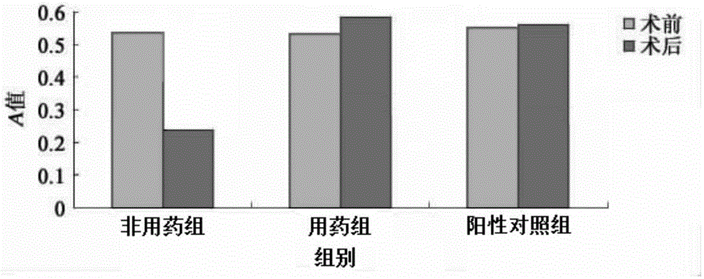 Traditional Chinese medicine composition for treating osteoporosis and preparing method of traditional Chinese medicine composition