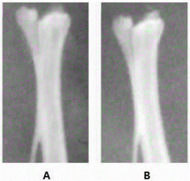 Traditional Chinese medicine composition for treating osteoporosis and preparing method of traditional Chinese medicine composition