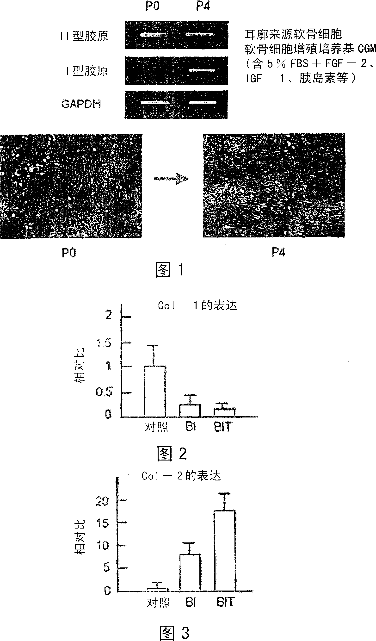 Medium for the redifferentiation of dedifferentiated chondrocytes into chondrocytes