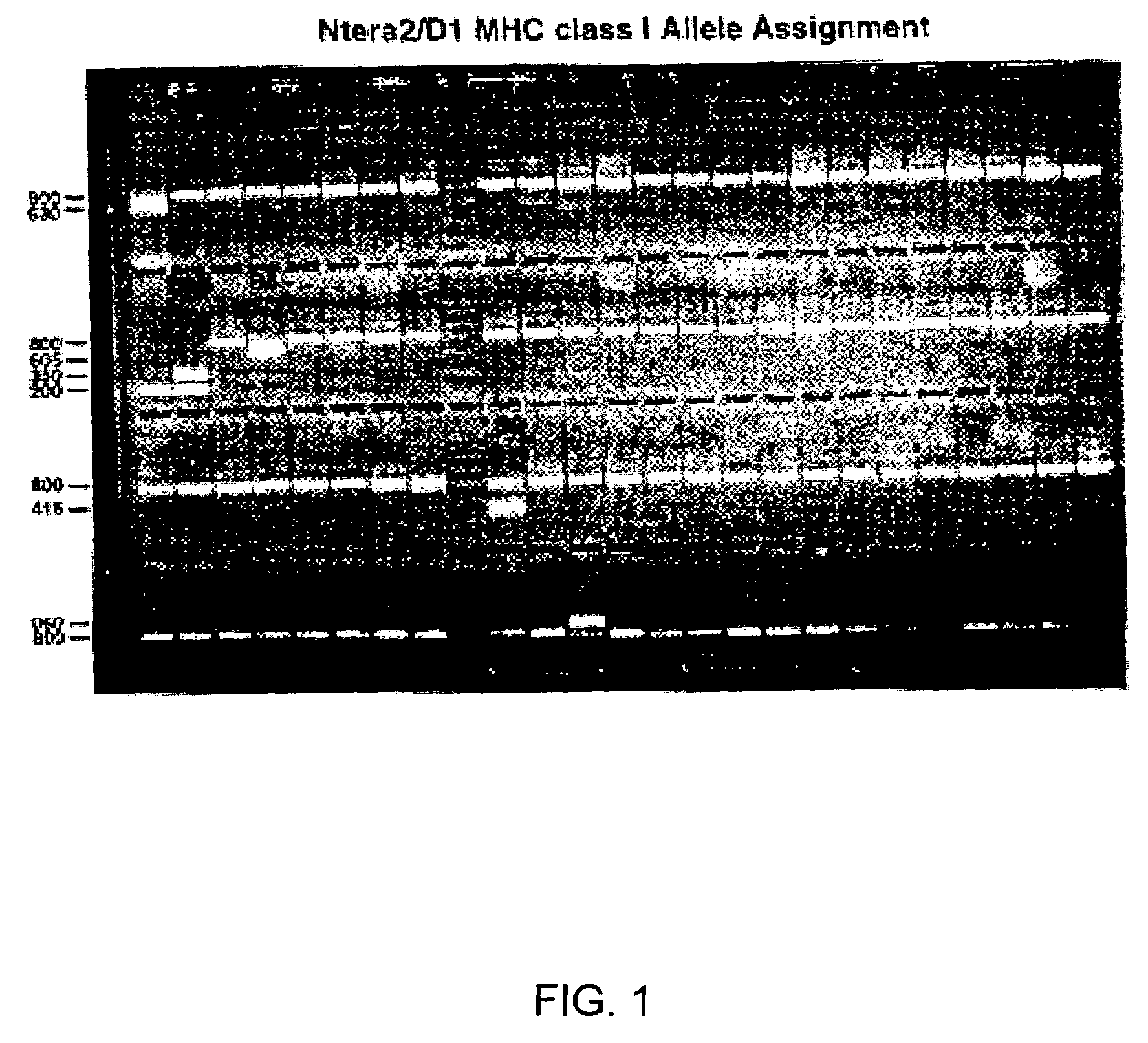 Human immunosuppressive protein