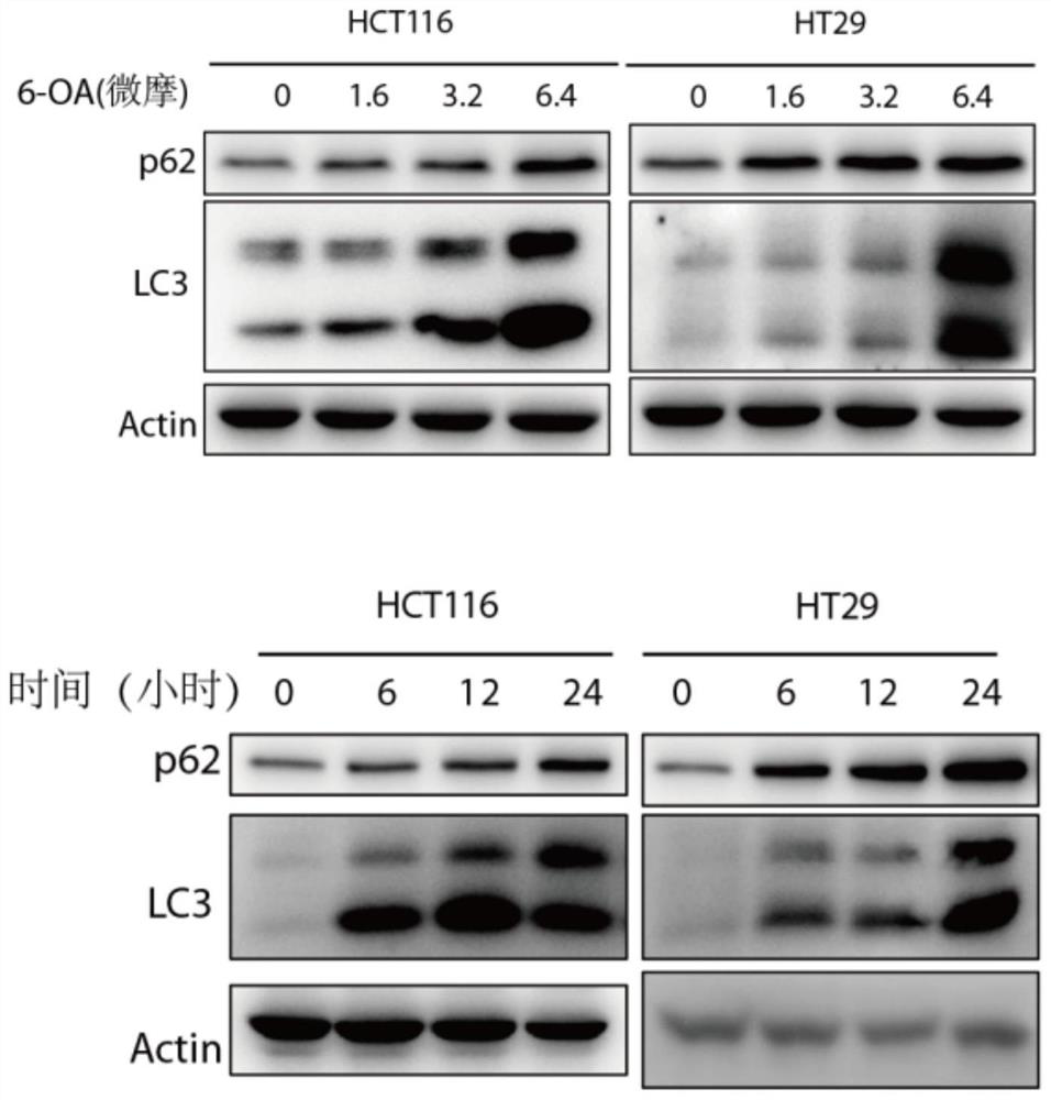 Application of erodium stephanianum willd element as autophagy-lysosome signal channel blocker