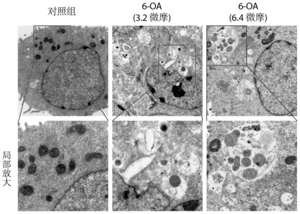 Application of erodium stephanianum willd element as autophagy-lysosome signal channel blocker