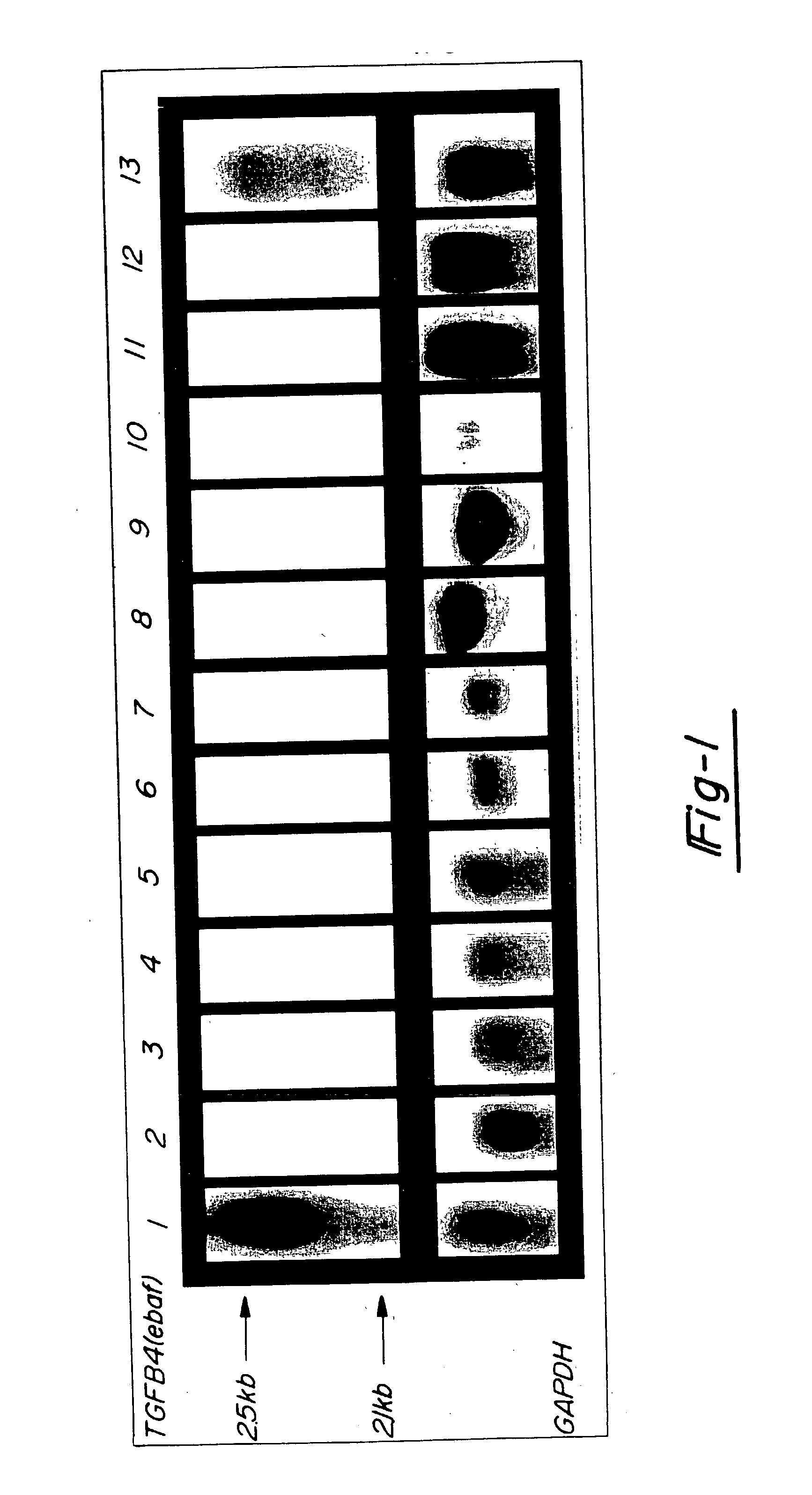 Method for diagnosing selected adenocarcinomas