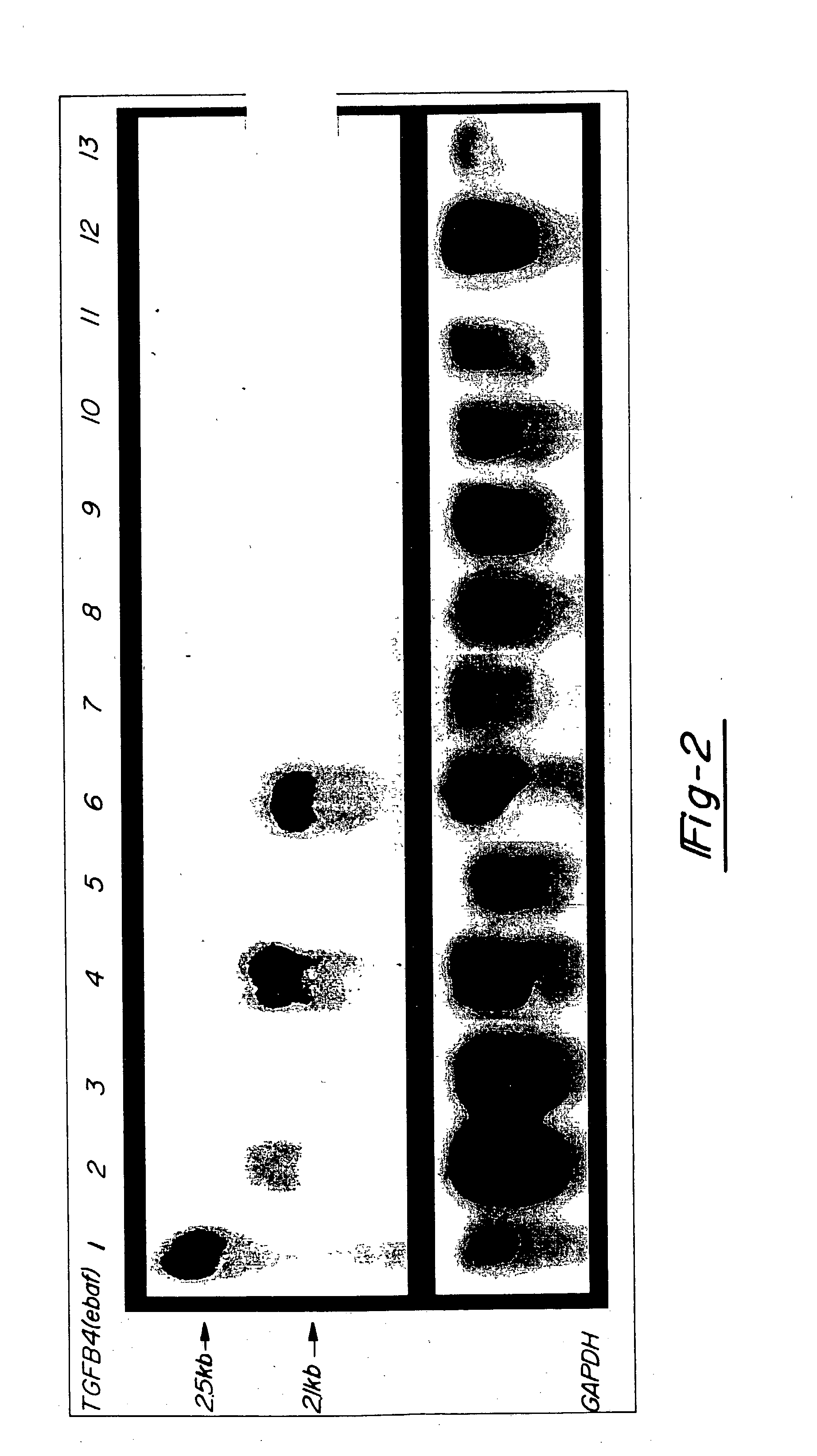 Method for diagnosing selected adenocarcinomas