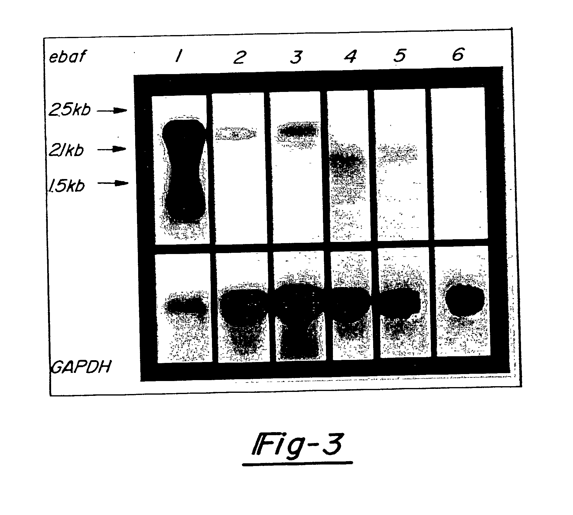 Method for diagnosing selected adenocarcinomas