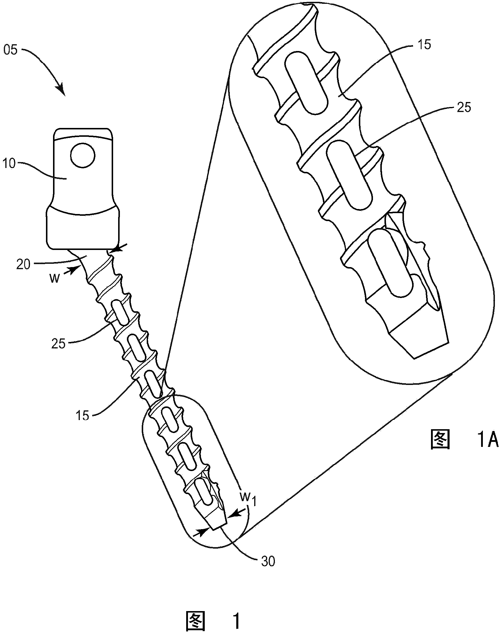 Bone fastener and methods of use