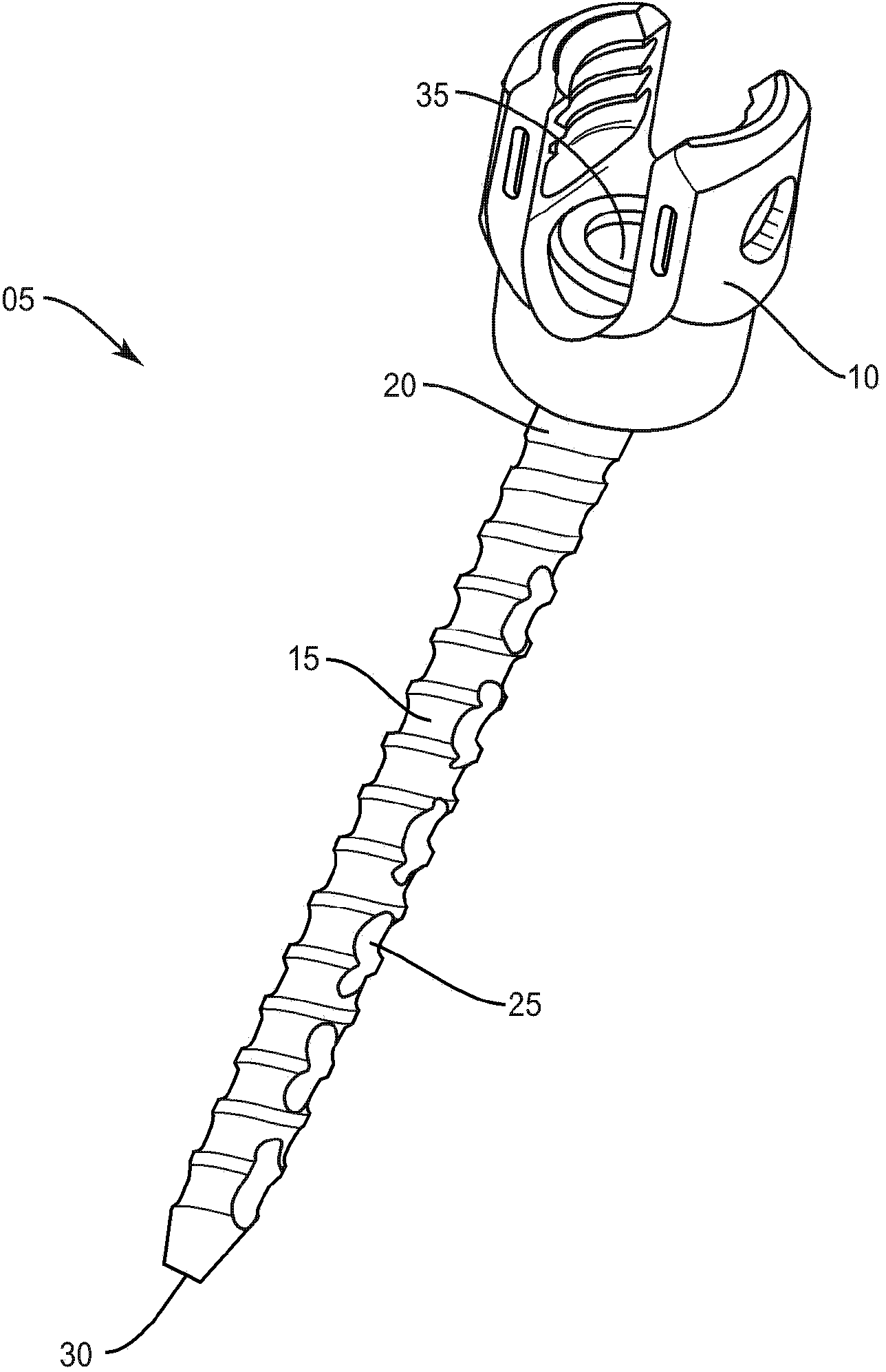 Bone fastener and methods of use