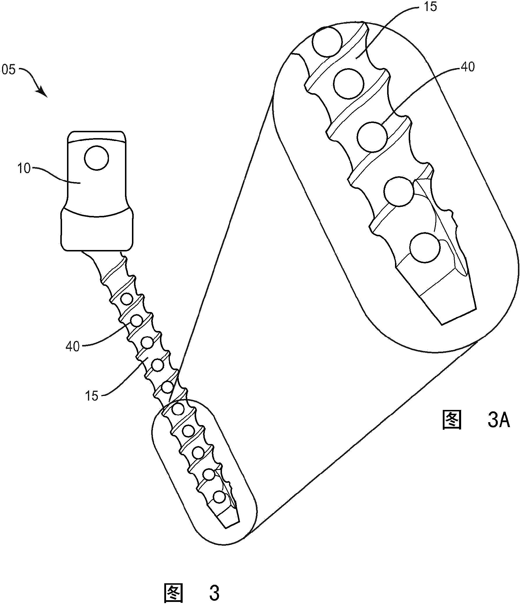 Bone fastener and methods of use