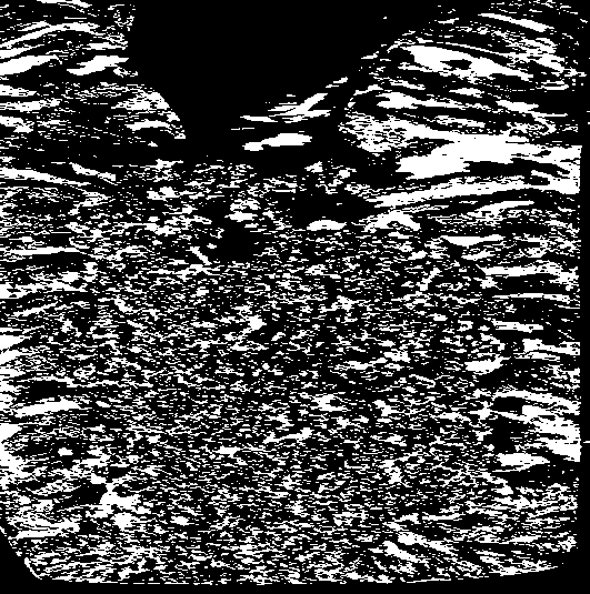 Method for refining metal solidification structure through complex pulse magnetic oscillation