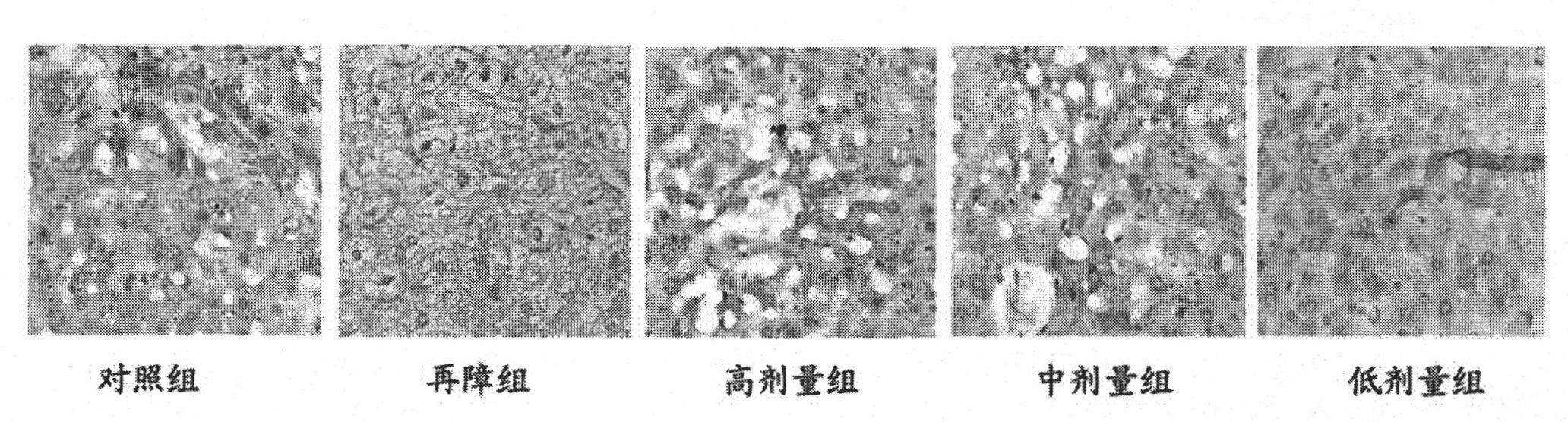 Application of nutrition combination in preparation of medicine for promoting proliferation of liver stem cells