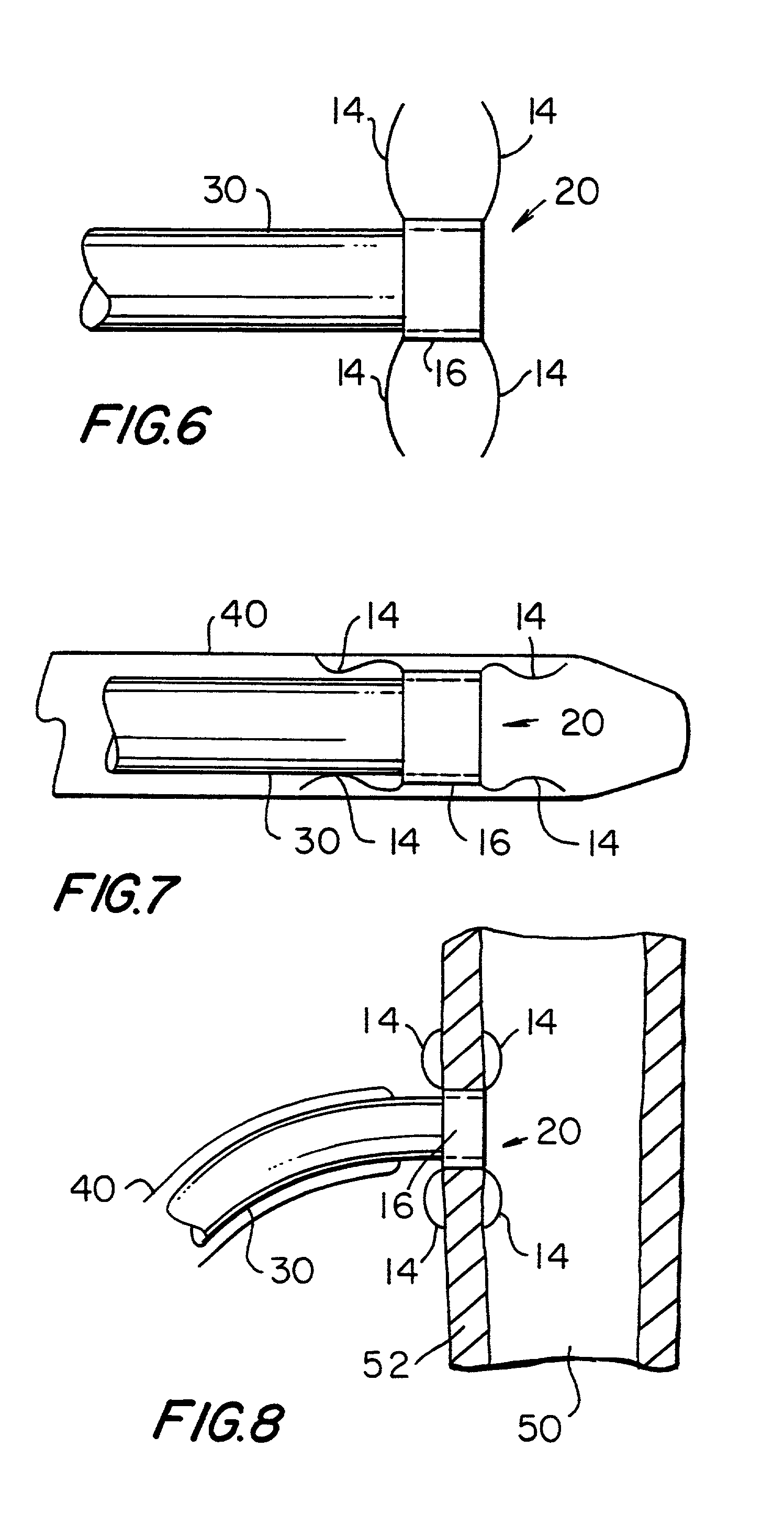 Medical graft connector or plug structures, and methods of making and installing same