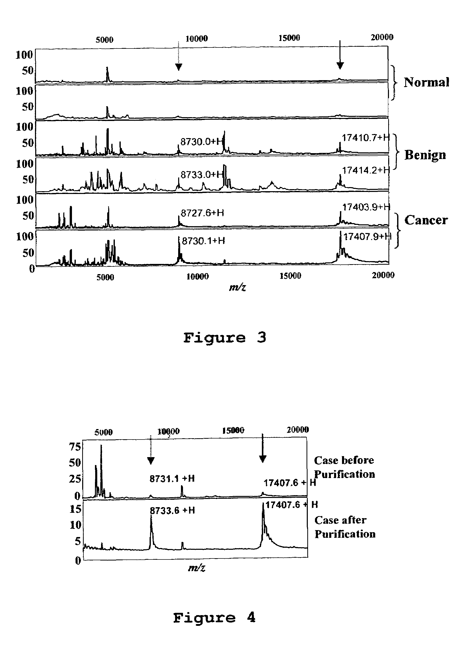 Eosinophil-derived neurotoxin as a marker for ovarian cancer