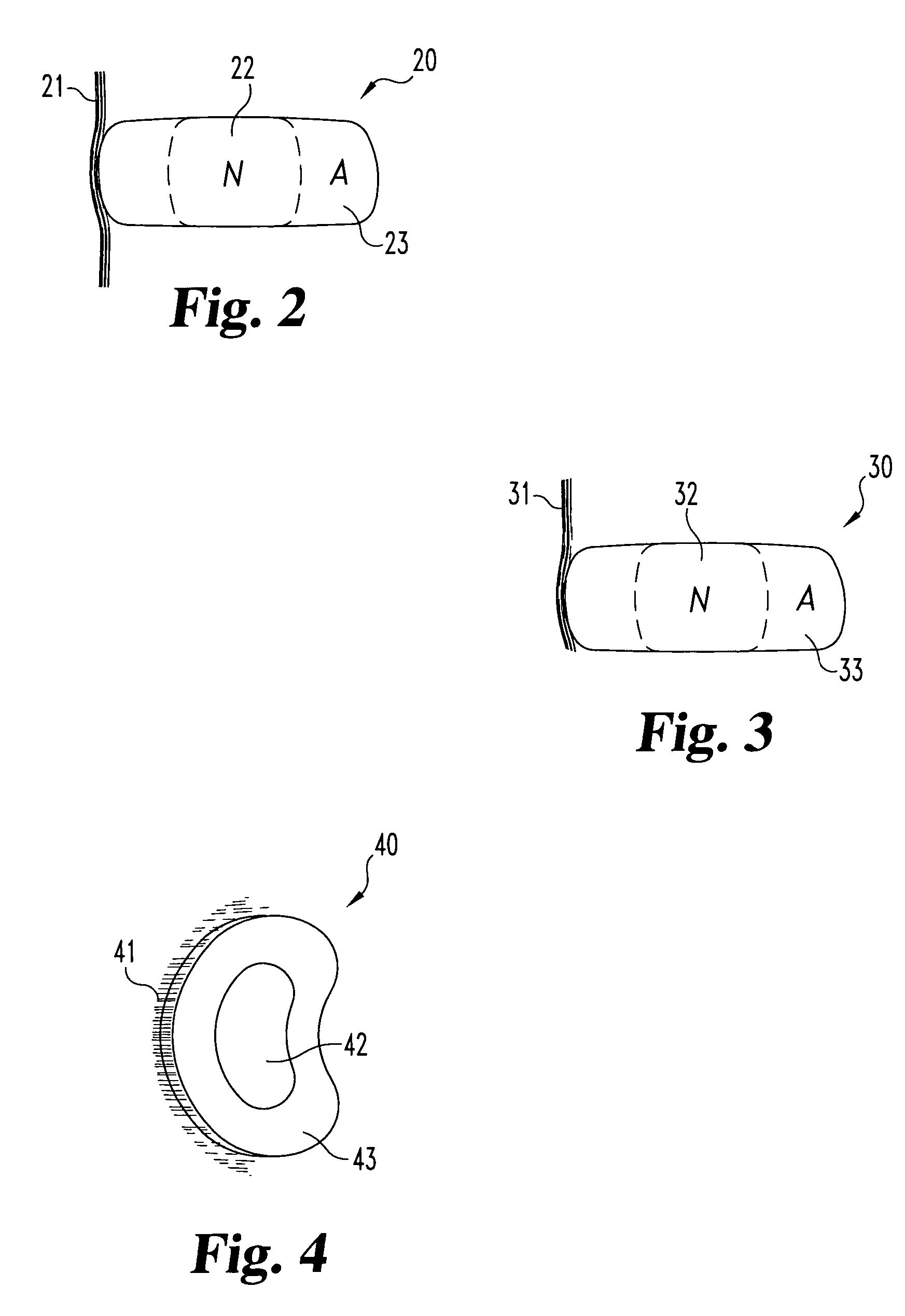 Allogenic/xenogenic implants and methods for augmenting or repairing intervertebral discs