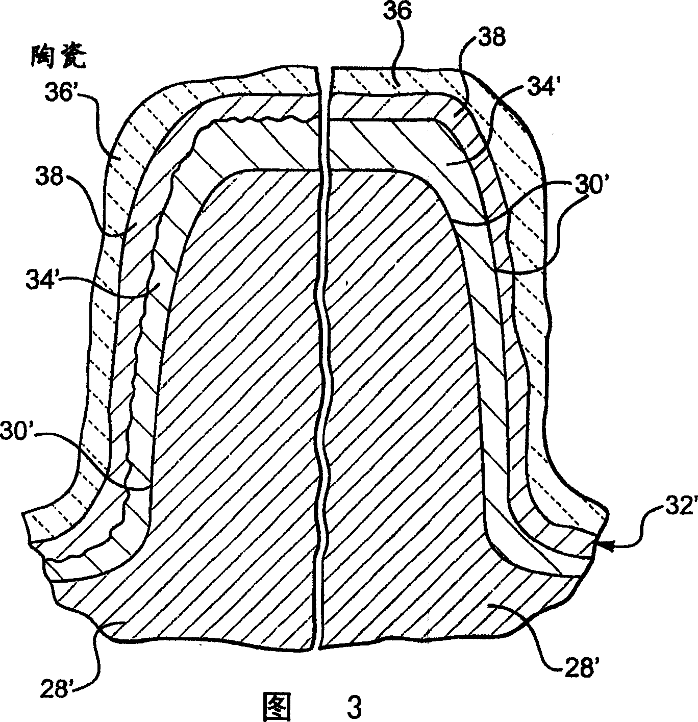 Planetary gearset with multi-layer coated sun gear