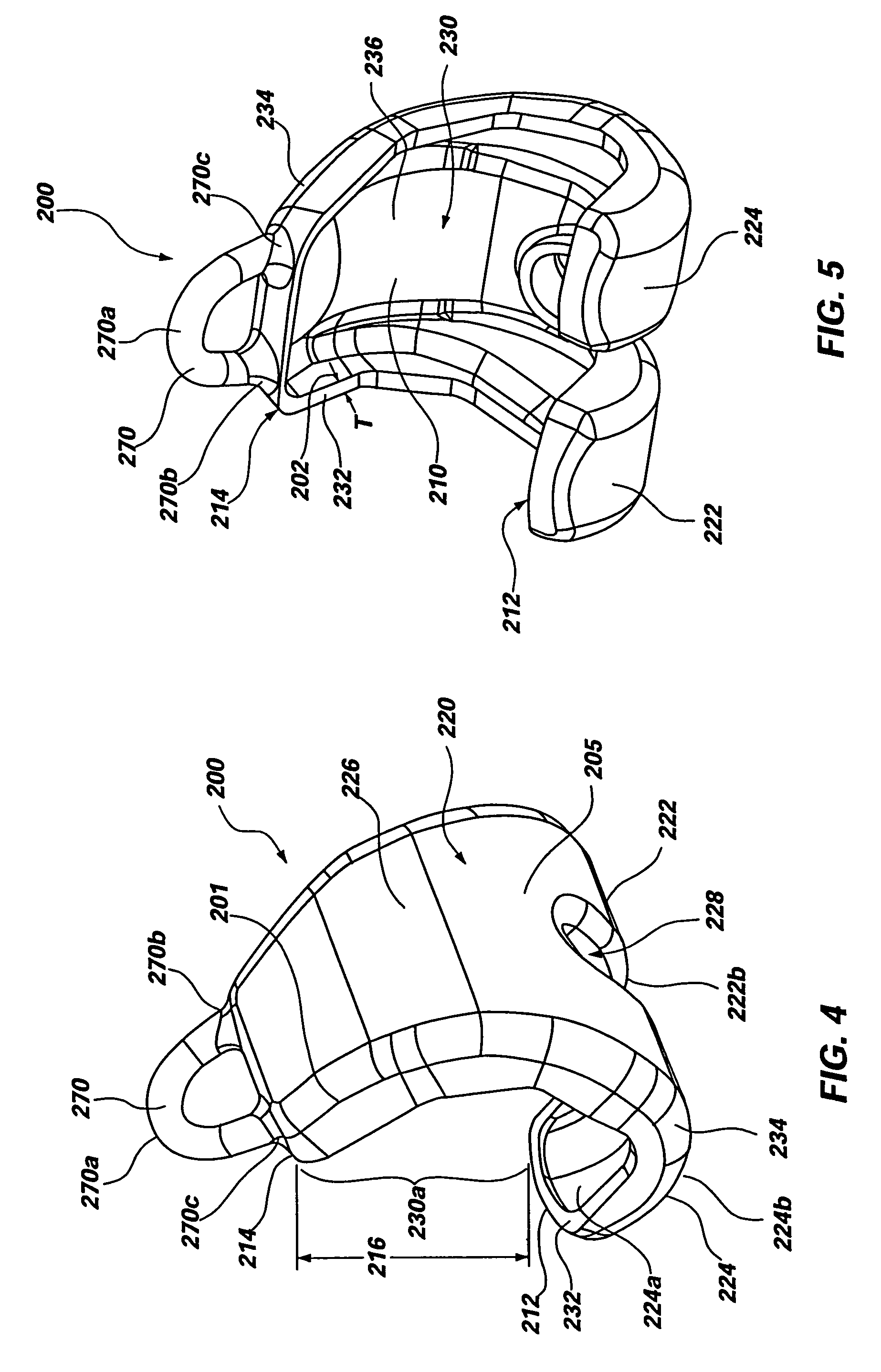 Method of forming a temporary prosthetic joint using a disposable mold