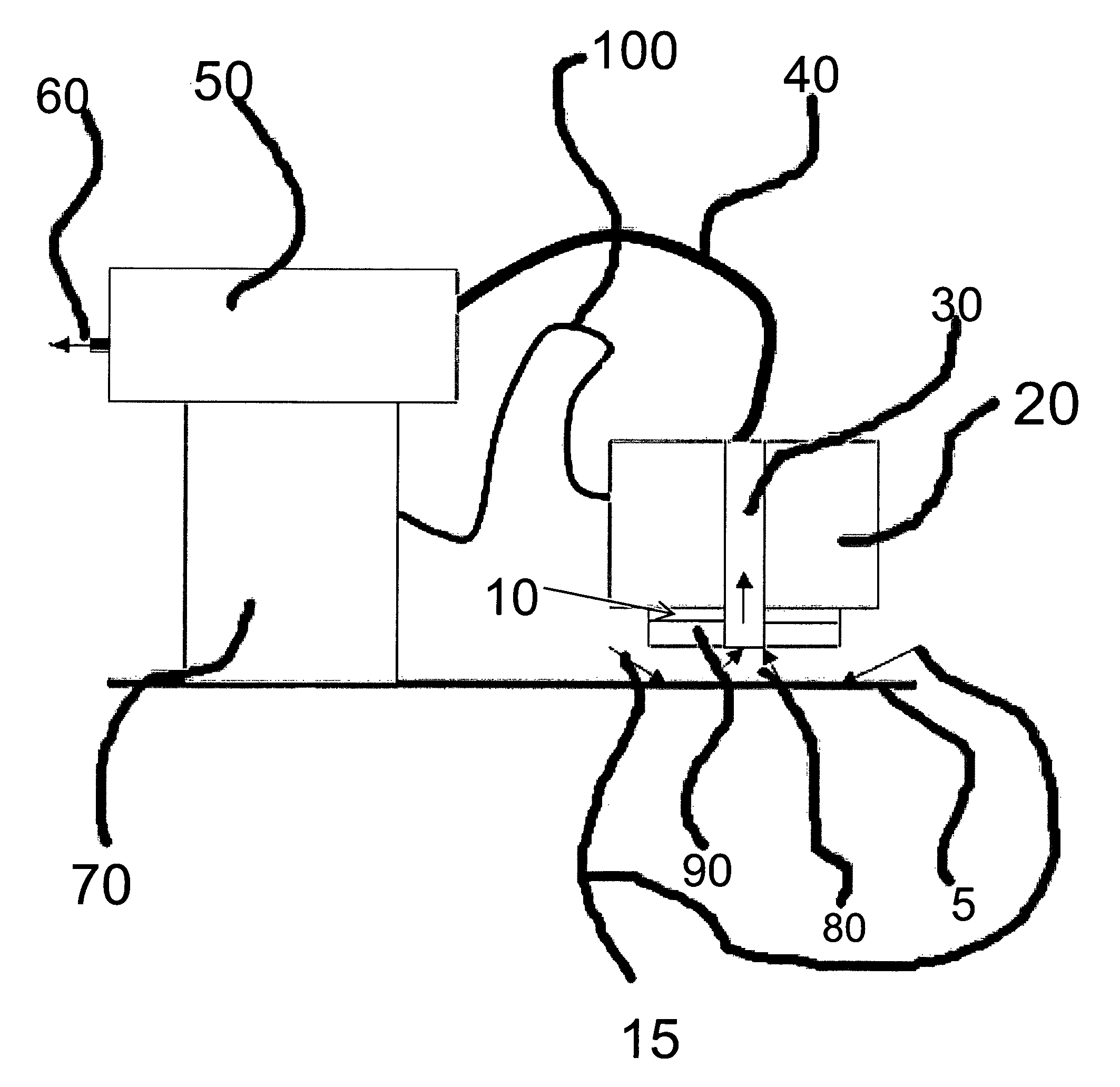 Surface particle counter