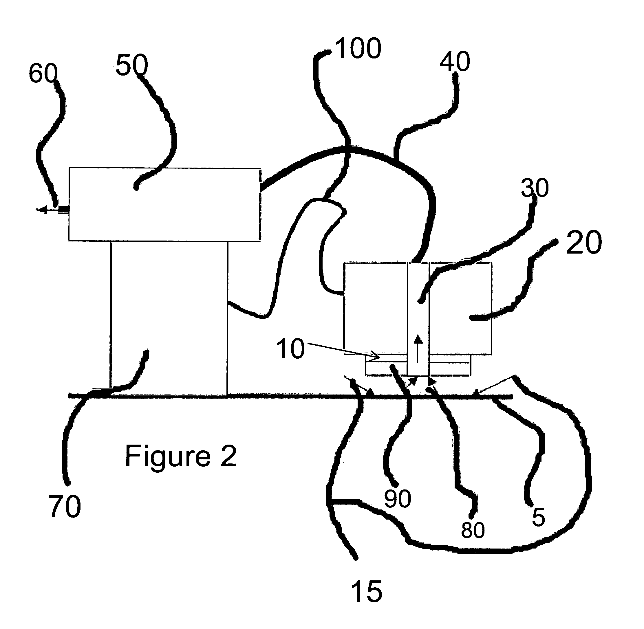 Surface particle counter