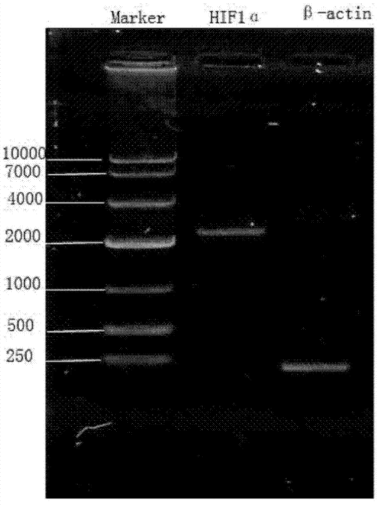 Application of growth factor gene drug in preventing and treating stress-related gastrointestinal injury