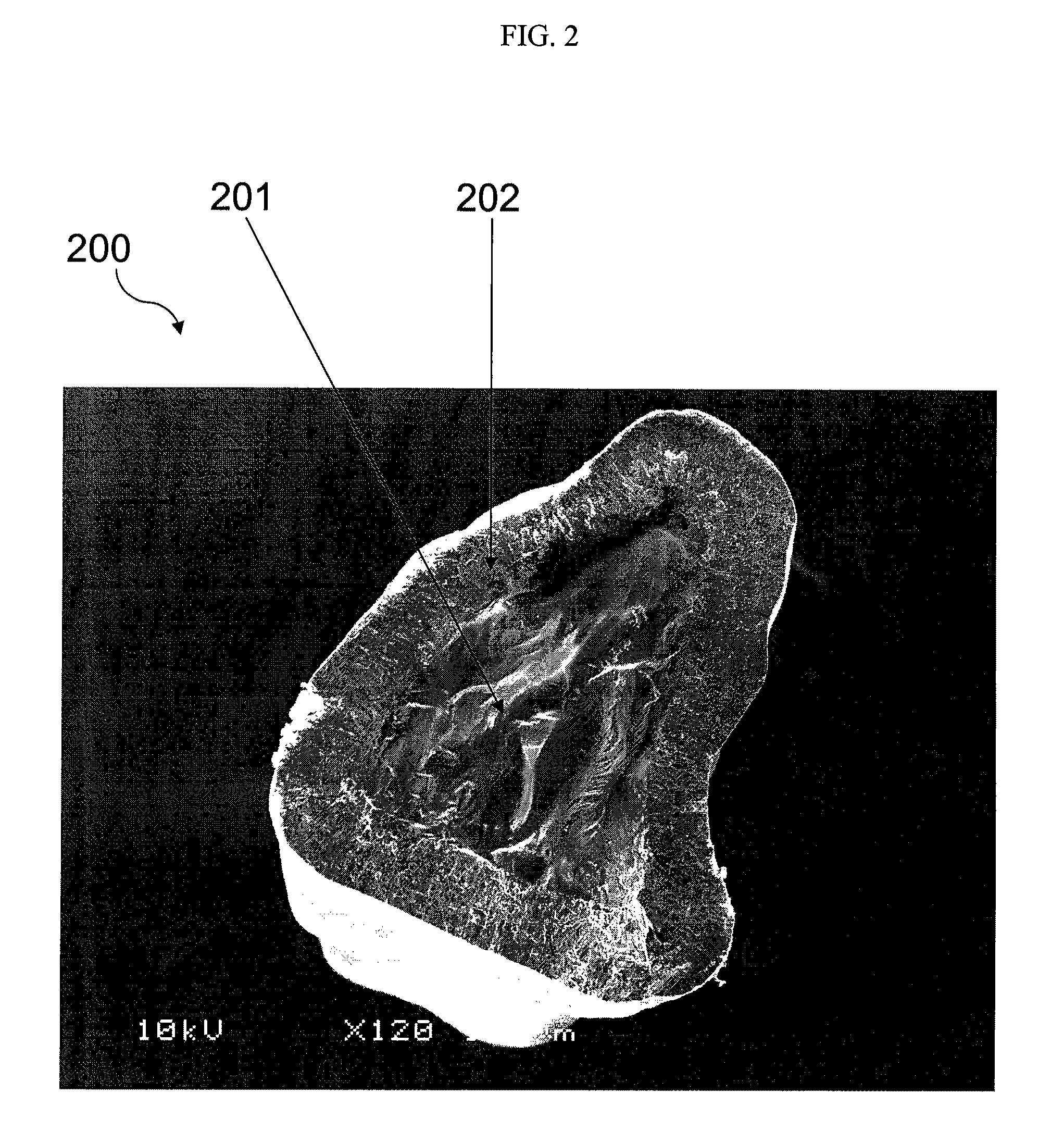 Pharmaceutical Capsules Comprising Extended Release Dipyridamole Pellets