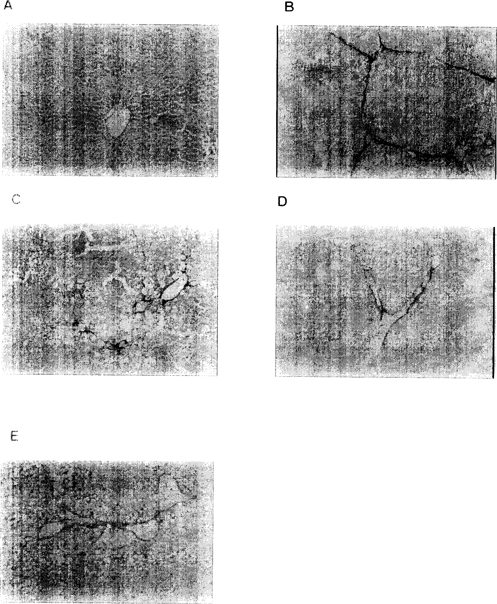 Chinese medicine compound preparation for treating chronic hepatic disease and its preparing method