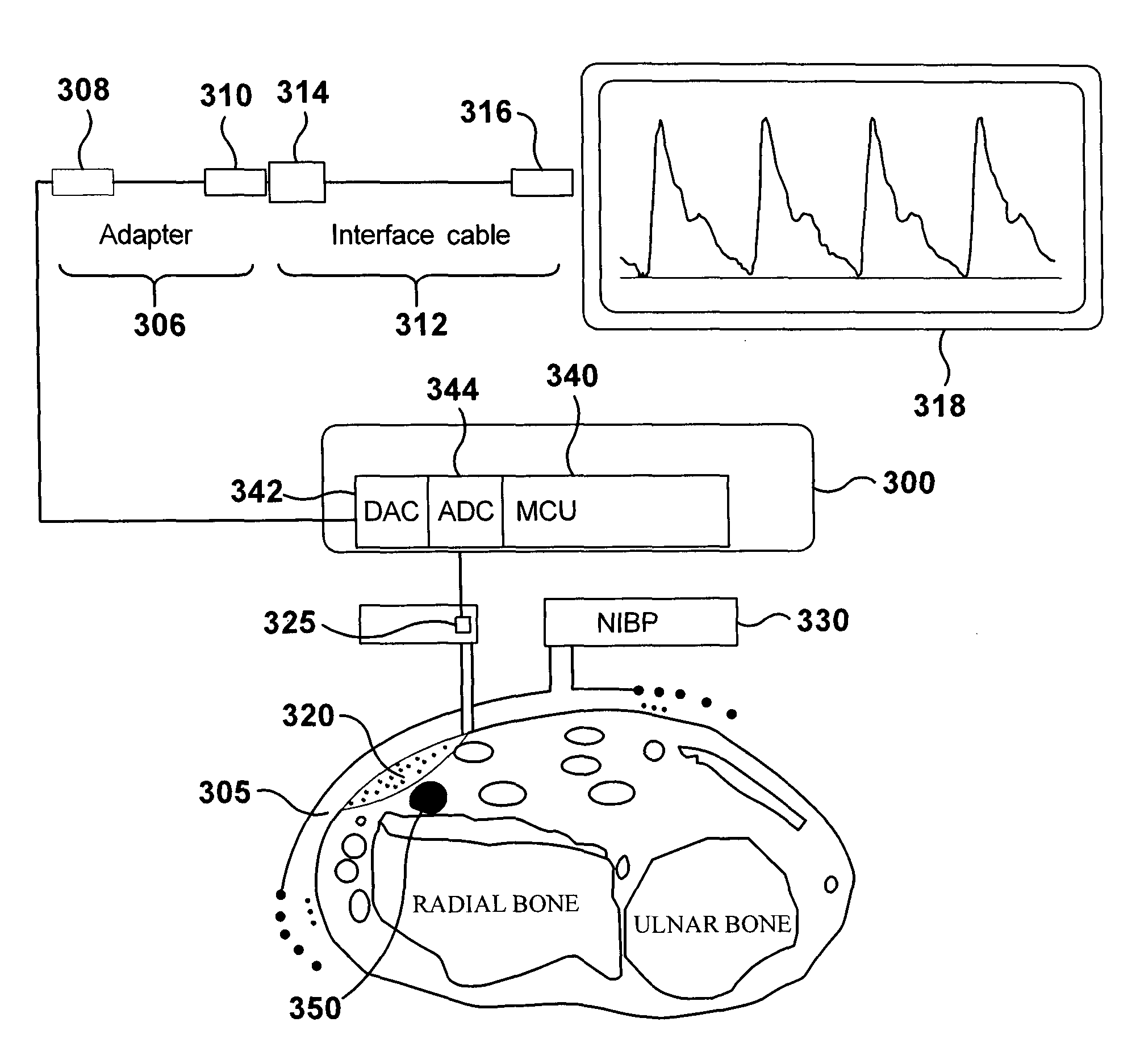 Apparatus and method for continuous oscillometric blood pressure measurement