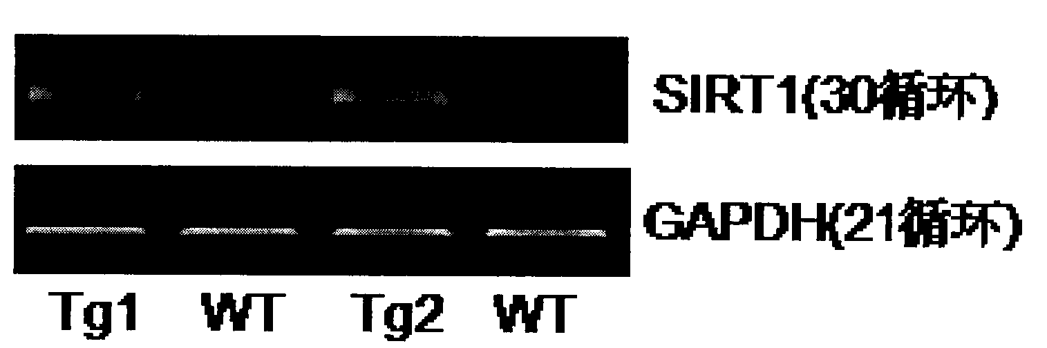 Application of SIRT (Silent Mating Type Information Regulation 2 Homolog 1) to prepare medicine used for regulating down the expression of cyclin D1