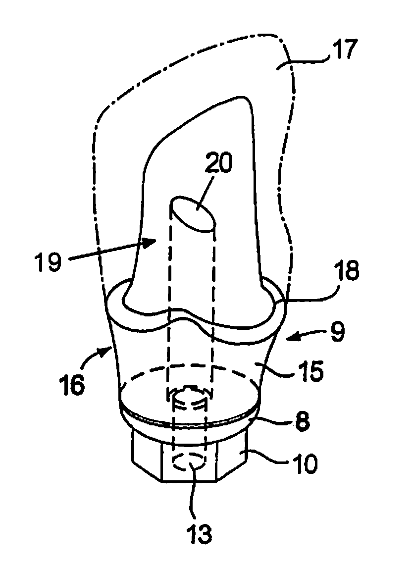 Method for manufacturing implant abutments for dental implants, and an implant abutment for a dental implant