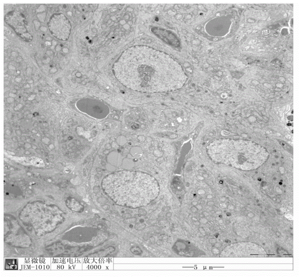 Application of catalpol in preparing ovarian aging resisting medicaments