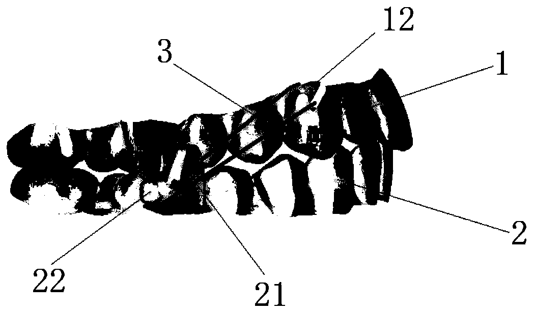 Bracket-free invisible orthodontic device capable of guiding lower jaw to move by traction and manufacture method thereof