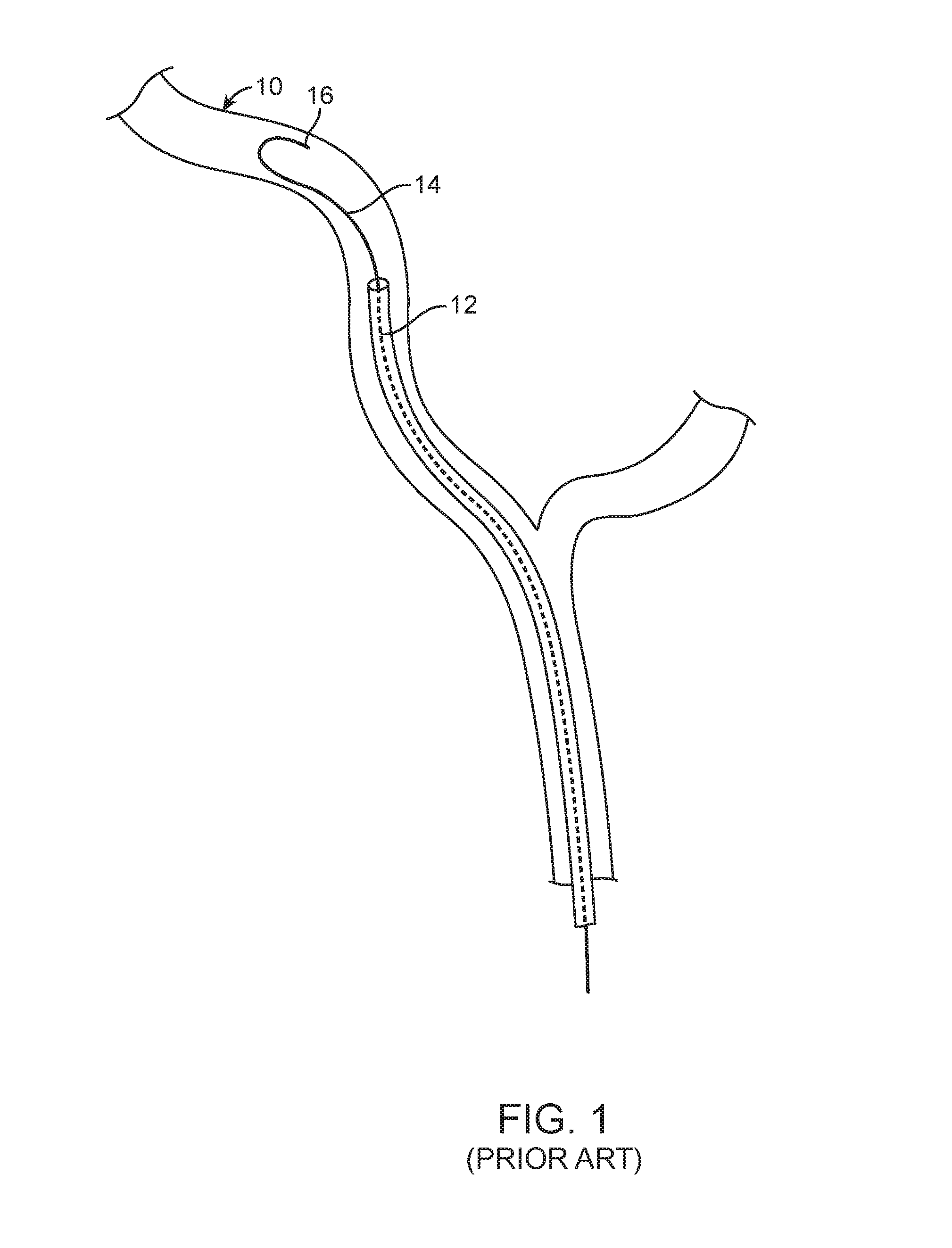 Expandable tip medical devices and methods