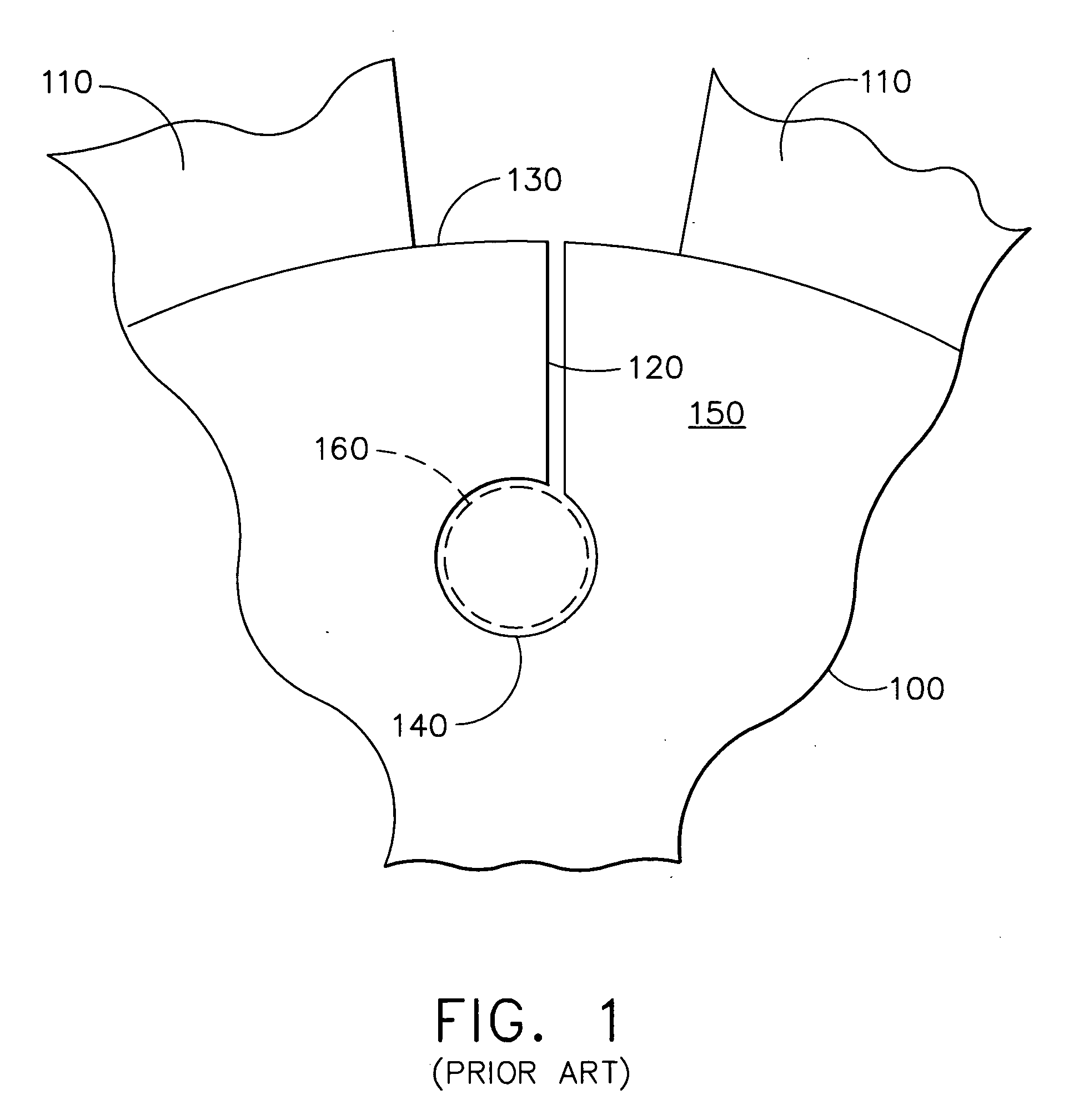 Hoop stress relief mechanism for gas turbine engines