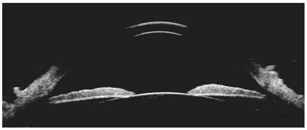 An anterior segment three-dimensional ultrasound scanning imaging device and method