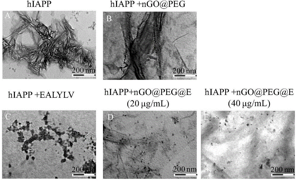 Functionalized nano graphene oxide supported insulin derivative material, preparation method thereof and application in preparation of medicine for treating diabetes