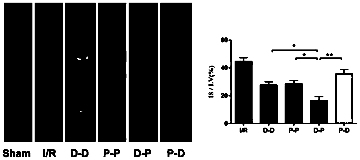 Use of mitochondrial complex I reversible inhibitor combined with active oxygen scavenger to prepare ischemia-reperfusion injury protection drug