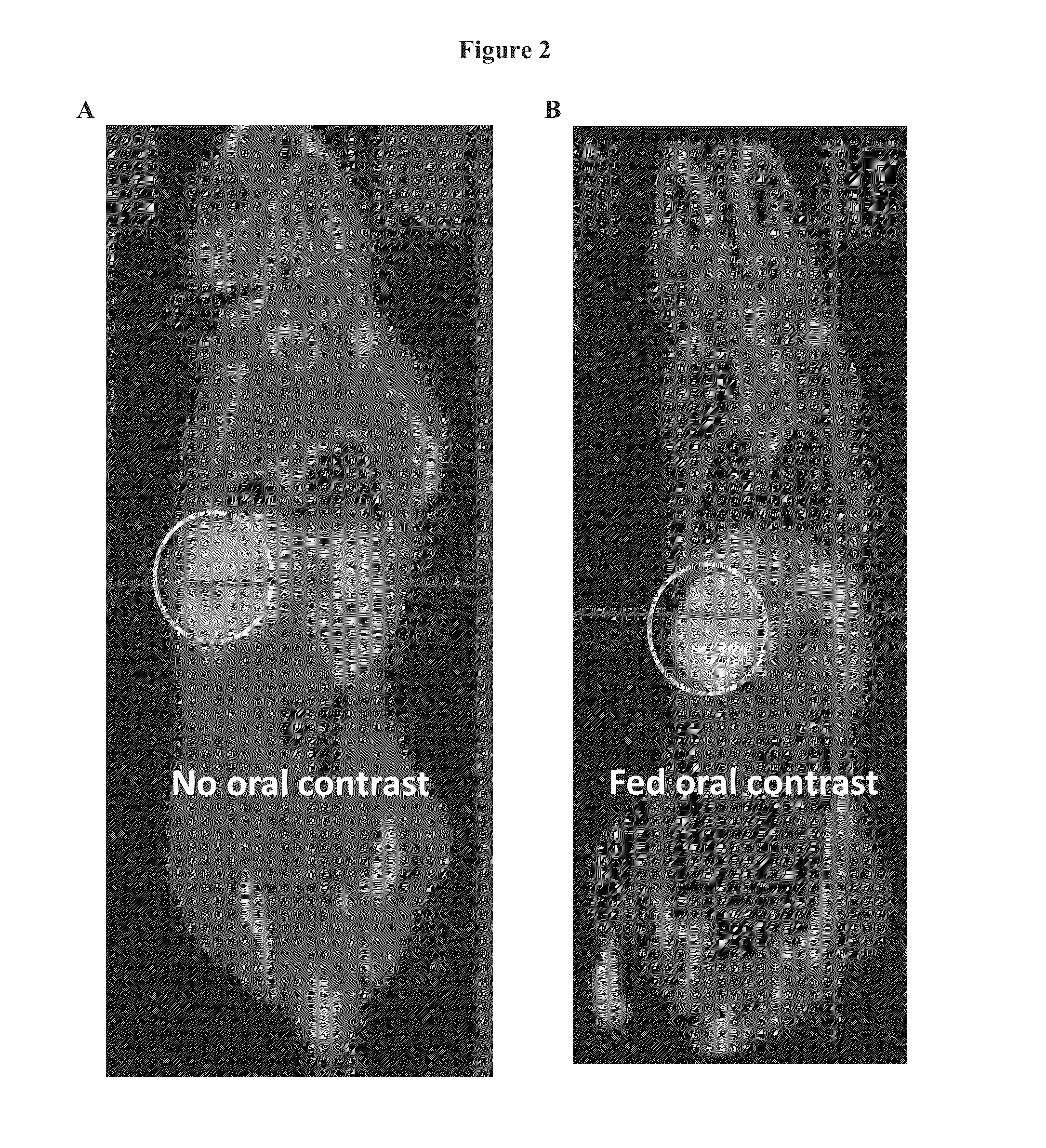 Radiotracer imaging using sodium iodide symporter polypeptides