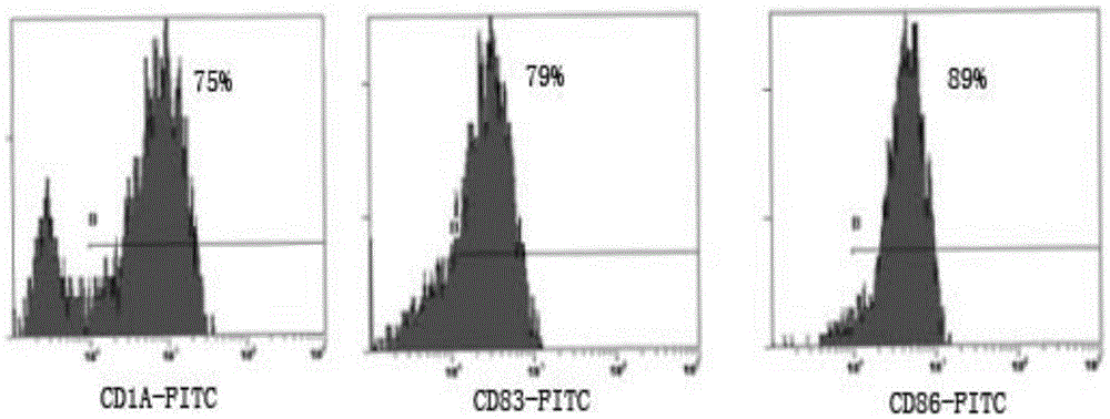 Method for preparing anti-tumor combined immune cells DC (dendritic cell)-CIKs (cytokine induced killers) and NKs (natural killers) simultaneously and prepared combined immune cells