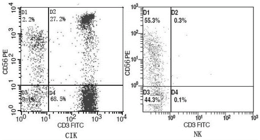 Method for preparing anti-tumor combined immune cells DC (dendritic cell)-CIKs (cytokine induced killers) and NKs (natural killers) simultaneously and prepared combined immune cells