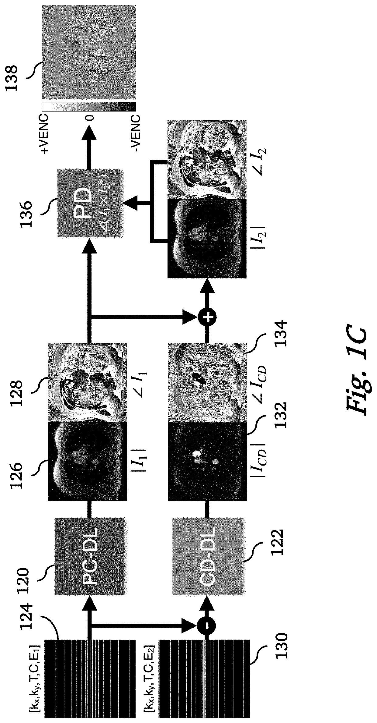 Artificial Intelligence based reconstruction for Phase Contrast Magnetic Resonance Imaging