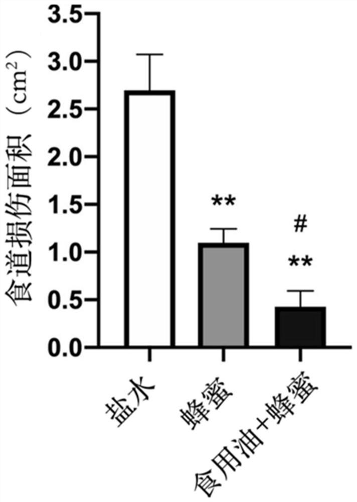 Liquid composition for preventing battery foreign matters from damaging esophagus and application of liquid composition