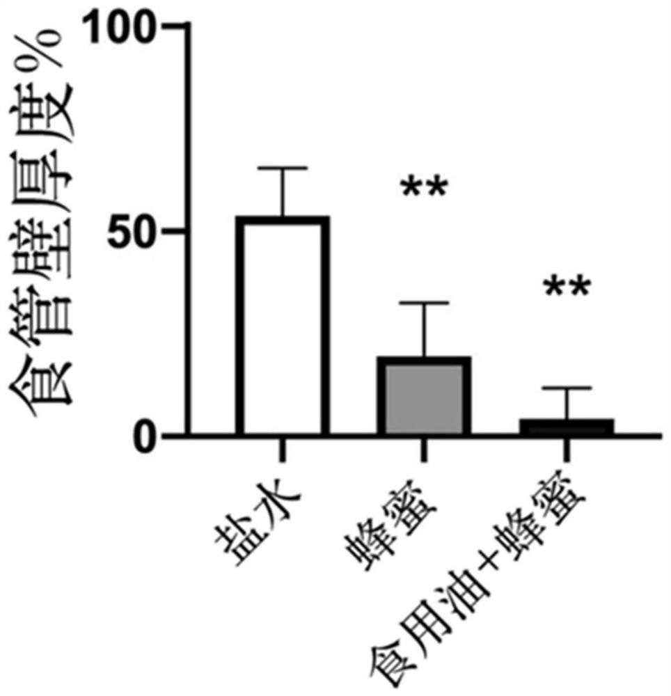 Liquid composition for preventing battery foreign matters from damaging esophagus and application of liquid composition