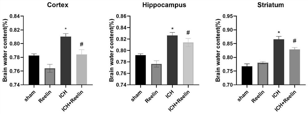 Application of exogenous recombinant protein Reelin in preparing medicament for treating cerebral hemorrhage