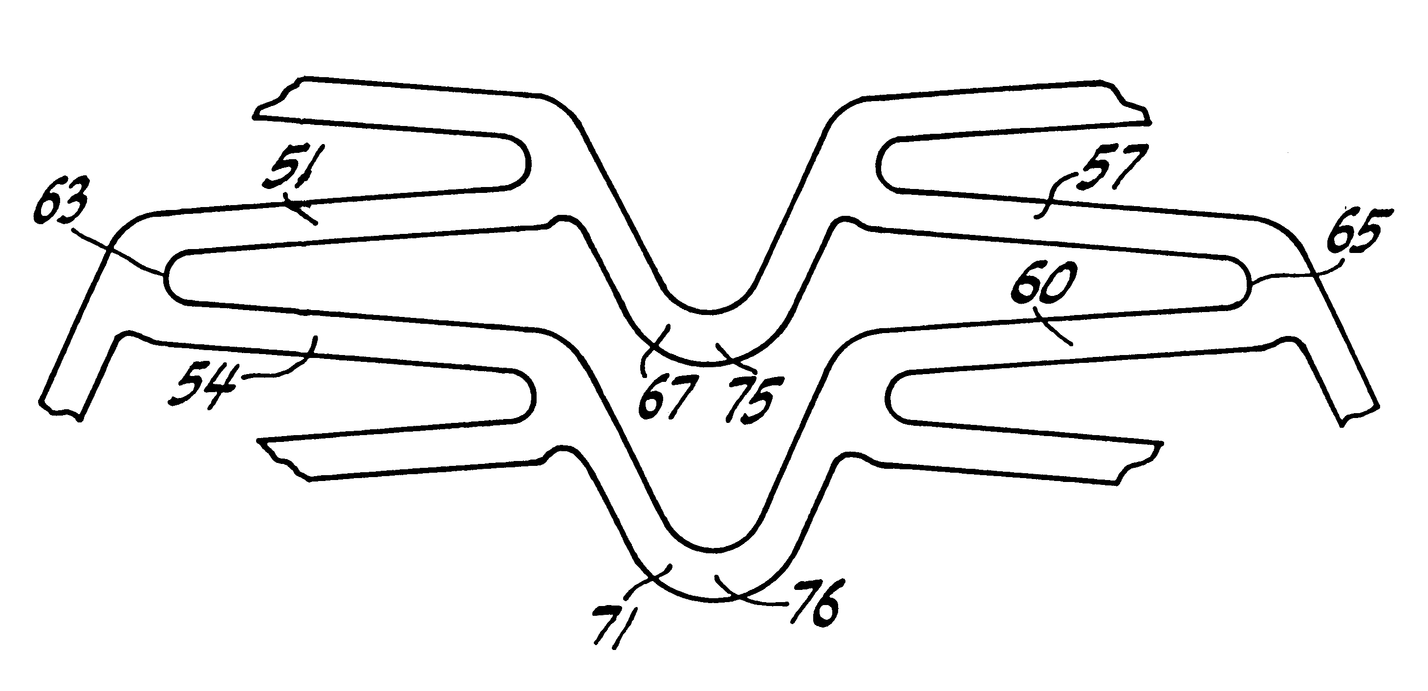 Stent fabrication method