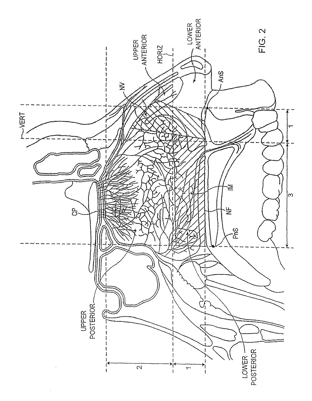 Nasal delivery