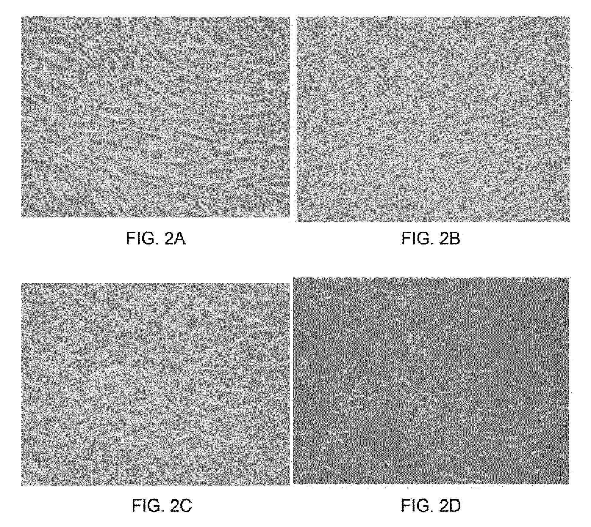 Systems and methods for making hepatocytes from extrahepatic somatic stem cells and use thereof