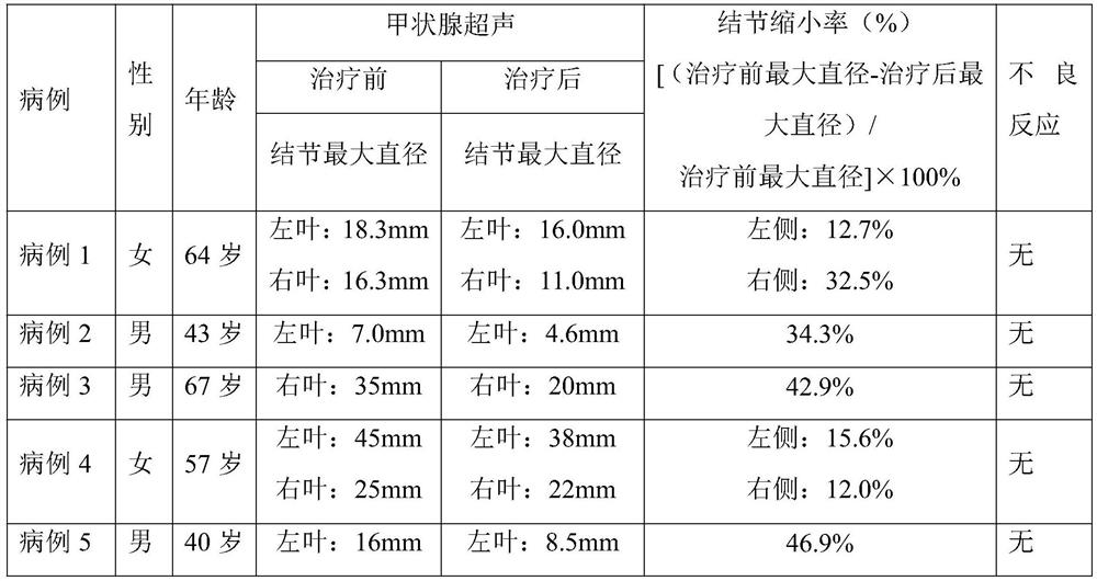 External traditional Chinese medicine composition for treating thyroid nodules and preparation method and application of external traditional Chinese medicine gel plaster