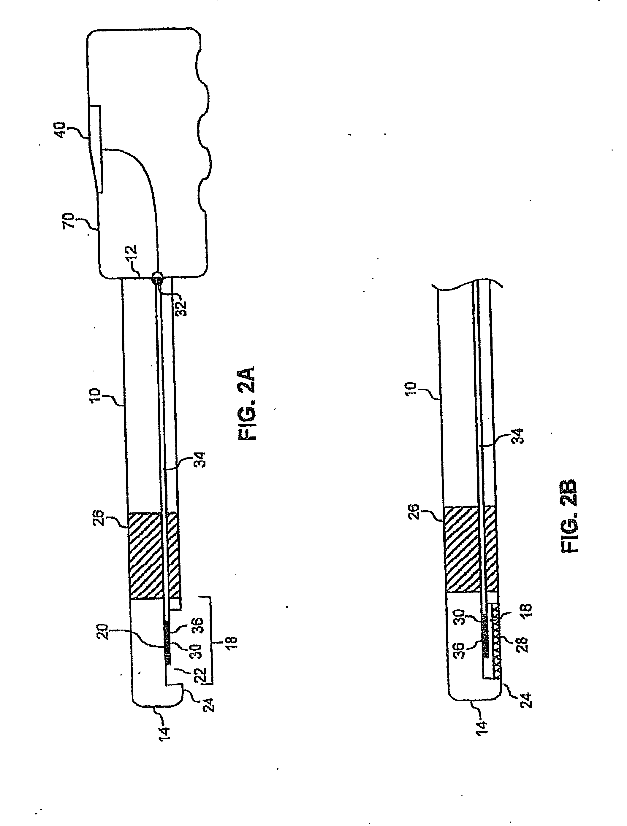 Noninvasive detection of a physiologic parameter with a probe