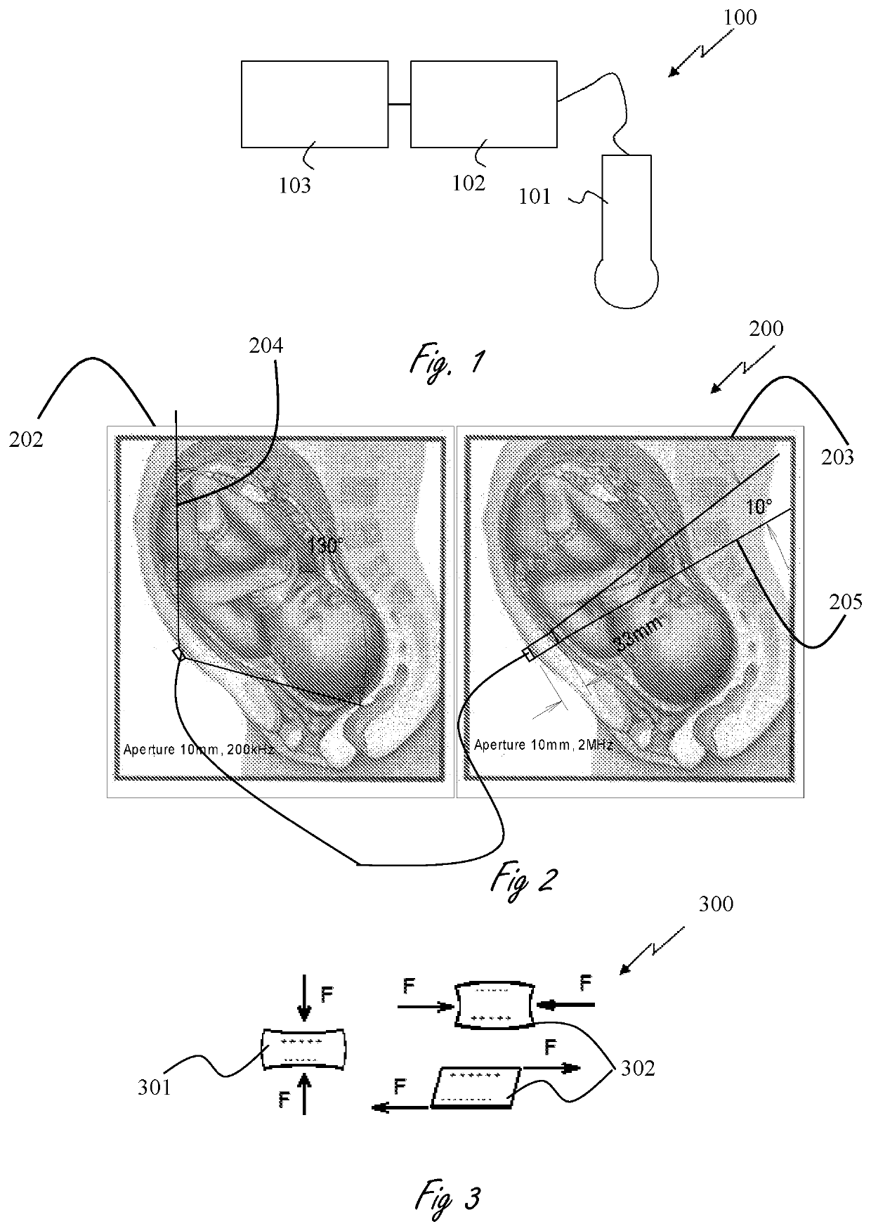 Fetal heart rate monitoring system