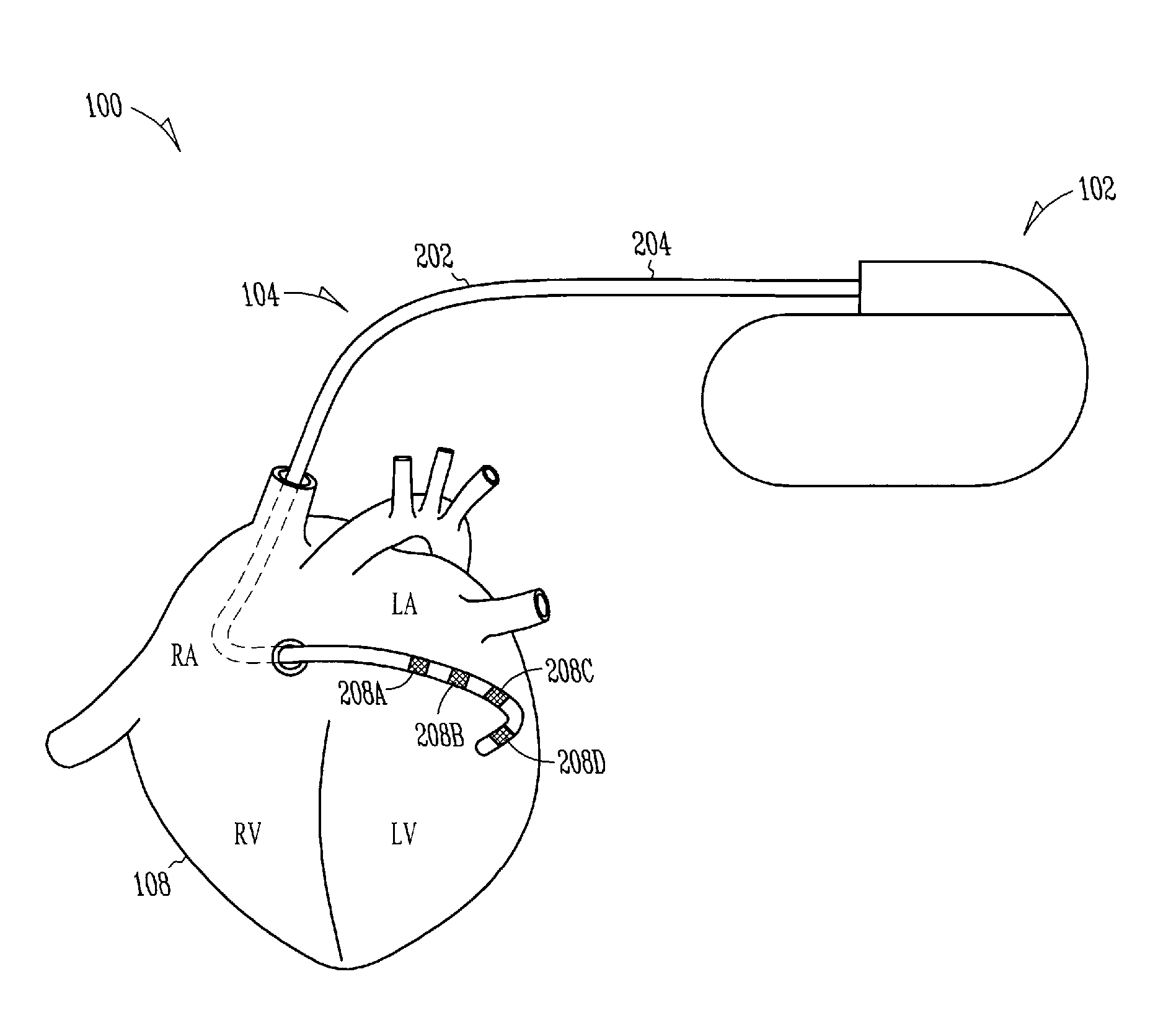 Lead with fibrous matrix coating and methods related thereto